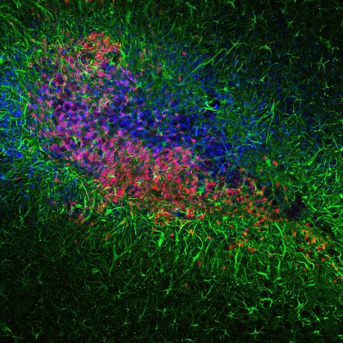 Photo Contest_2014_Lux University_Human neural stem cells successfully transplanted into an adult mouse brain_Kathrin Hemmer.jpg 